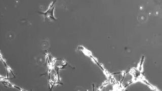 This is time lapse footage of neurons... - Emre Murat Varlık